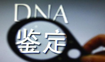 司法鉴定费用